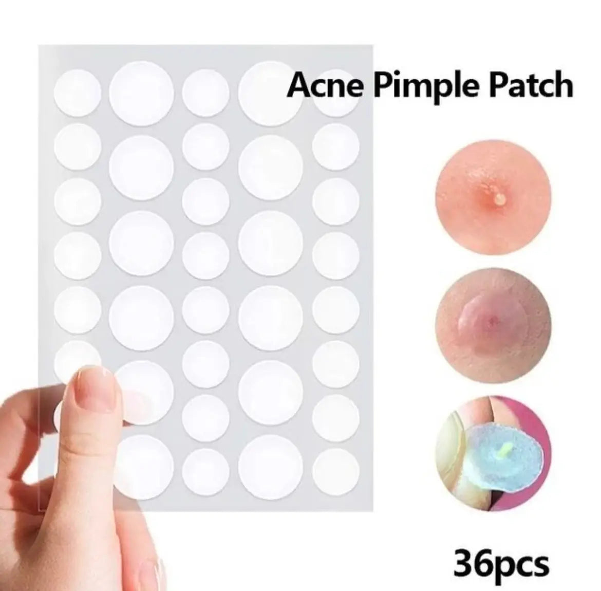 70030 70075 PARCHES PARA ACNE HEALING hydrocolloid CELAVI 36PCS